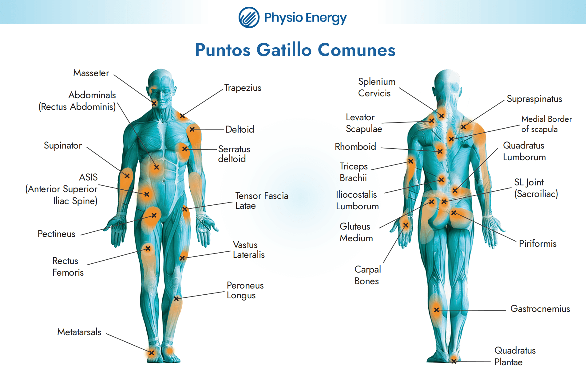 puntos gatillo opt