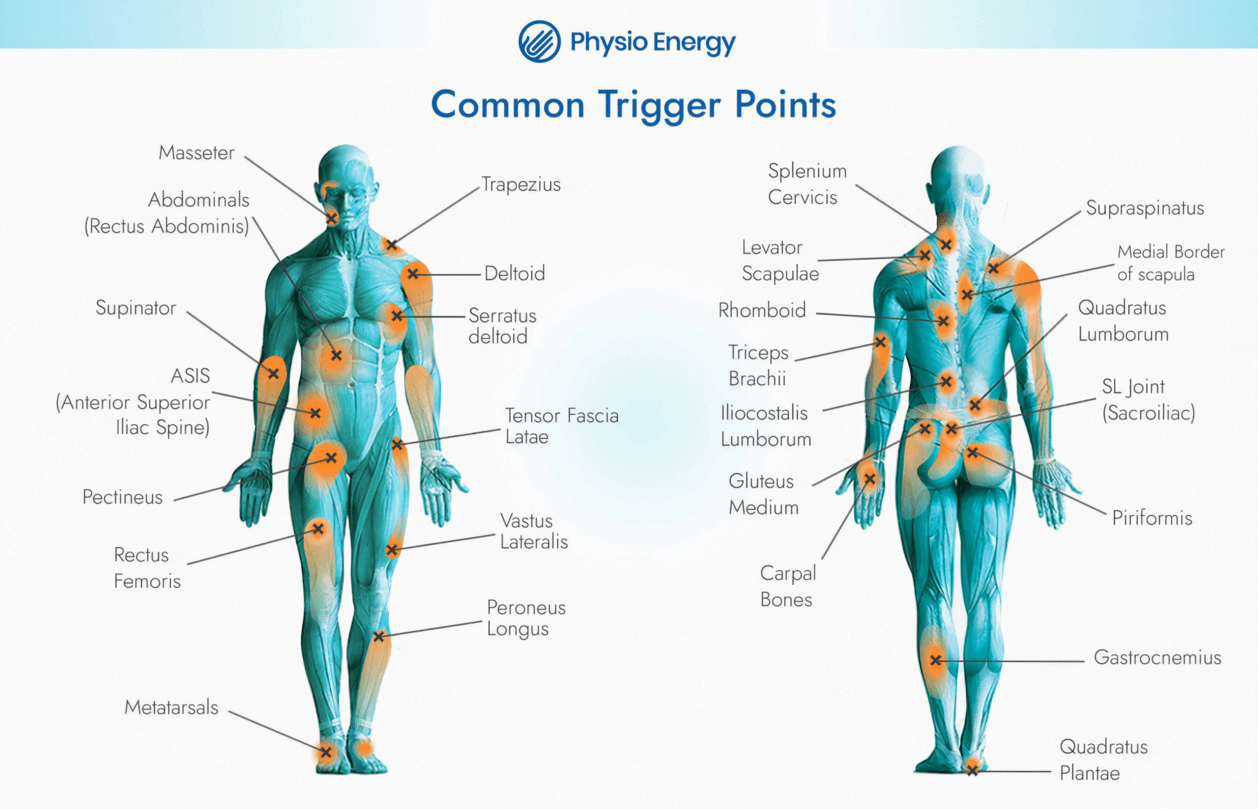 Trps Map Physio Energy Landing Opt